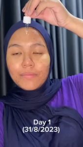 Elysian Whitening Set - Dry Skin Sensitive Skin Alcohol Free Kecut Jerawat Pudar Jeragat Parut Hitam Liang Pori