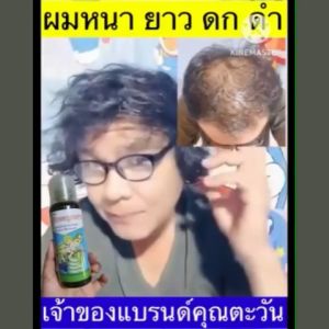 ผมบาง หัวล้าน อย่ารอให้ล้านหมดหัว! แค่ใช้ "แชมพูสมุนไพรคุณยาย" 💚 แชมพูแก้ผมบาง สูตรสมุนไพร 17 ชนิด