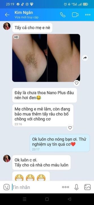 Kem%20t%E1%BA%A9y%20l%C3%B4ng%20nano%20gel%20-%20Image%207