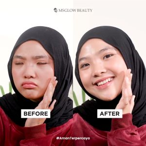 MS GLOW - MAXI ROYAL-C ELIXIR - 15 ML