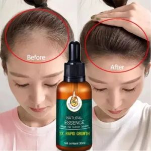 EELHOE Semprotan Penumbuh Rambut Hair Growth Serum Hair Growth Spray Repair Damaged Moisturizing Nutrition Baldness Prevention 30ml