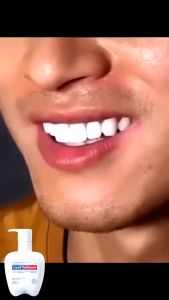 Odol Pemutih Gigi & Penghilang Karang Gigi Membandel