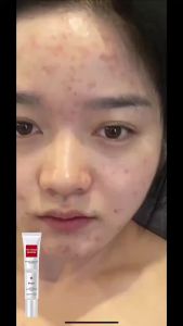 Krim Penghilang Flek Hitam & Melasma Whitening Freckle