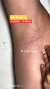 ครีมรักแร้คามู  Camu ครีมรักแร้ คามู รักแร้ขาว รักแร้คามูบอสหนุ่ม ซึมไว ลดตุ่มหนังไก่ ระงับกลิ่นทั้งวัน Beyond underarm cream