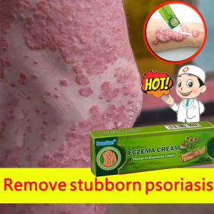 20G Chinese Herbal Skin Psoriasis Skin Disease Killer Eczema Treatment Cream/Psoriasis Treatment Cream/Ringworm Dermatitis Ointment Antibacterial Cream