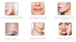 Foreverlily 3in1 Professional Diamond Microdermabrasion Machine Facial Peeling Wrinkle Dermabrasion Beauty Machine Exfoliation Face Deep Cleaning Skin Care Rejuvenation