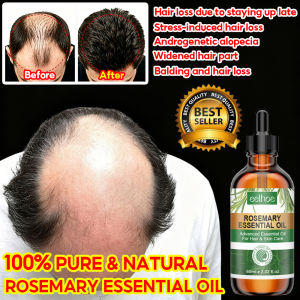 In stock Original rosemary oil for hair growth serum rambut gugur hair growth tonic rambut serum hair oil 60ml