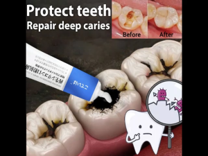 Anti-cavity toothpaste whitening toothpaste tartar removal toothpaste anti-cavity toothpaste cleans teeth repairs damaged gums and whitens teeth