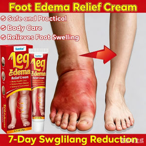 krim bengkak 20g leg edema cream ubat surut bengkak kaki membantu melancarkan darah kurangkan bengkak dan kesakitan 消肿膏