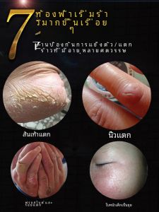 ครีมบำรุงมือ New Xile Joy Crack Repair Moisturizing Non-greasy Hydrating Healing Cracked Heel Balm ครีมบำรุงมือที่ดูแลผิวแห้งและริ้วรอย