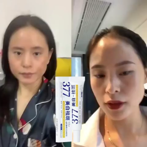 【COD&ORI】100% ORIGINAL Krim Pemutih 377 Krim Pemutih Penghilang Flek Hitam membandel  pemutih glowing cepat Pelembab Wajah Niacinamide Whitening Freckle Cream Mencerahkan warna kulit Remove Melasma Brighten Lighten Dark Spots Melanin Anti-Aging