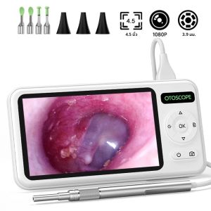 กล้องตรวจหูแบบดิจิตอลพร้อมจอ IPS 4.5 นิ้ว เลนส์ 3.9 มม. พร้อมไฟ LED 6 ดวง อุปกรณ์กำจัดขี้หู ไม้ทำความสะอาดหู