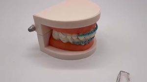 1Pair Colorful Stainless Steel Fake Braces Small Size Tooth Brace Decoration Fake Brackets Metal Wires Braces for Teenager