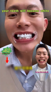 100% hiệu quả làm trắng kem đánh răng làm sáng răng trắng loại bỏ hơi thở hôi tươi nói lời tạm biệt vàng răng làm sạch vết bẩn răng cao răng nhẹ nhàng không kích thích 100g