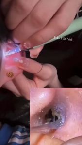 Dụng Cụ Lấy Ráy Tai Thông Minh Có Camera - Hình Ảnh Sắc Nét Sử Dụng An Toàn