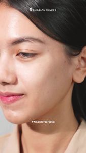 PAKET MS GLOW (Ultimate Luminous Whitening Acne White Cell DNA) | PAKET MS GLOW ORIGINAL 100% BPOM