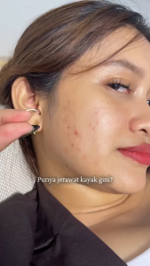 EILEEN GRACE - Moisturize Rose Jelly Mask 35ml