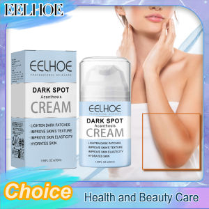 EELHOE | Eelhoe Private Parts Whitening Cream Underarms Knees Lighten Color Reduce Dark Color Moisturize Brightening Buttock Cream New