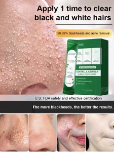 Centella asiatica to remove blackheads a touch of cleansing