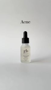 Gratitude Bar Acne Clear Drops (Bundle of 3) - Acne Treatment for Sensitive Skin with Retinyl Palmitate Zinc and Cica
