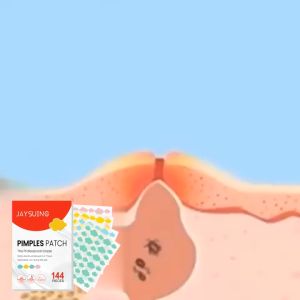 JAYSUING 144pieces Tempat Merah Berbentuk Awan: Membersihkan Kulit Lembut