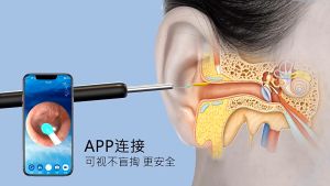 Bộ lấy ráy tai có camera nội soi không dây NE3 kết nối wifi