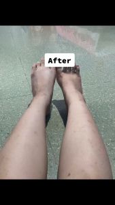 Great Life's Pekas Cream Remover: A Multi-Purpose Skin Care Solution