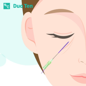 Chỉ thẩm mỹ - Chỉ White Duoten làm đầy xóa nhăn rãnh mũi má 1 gói 6 sợi