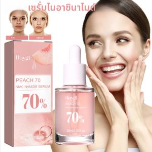 Niacinamide Facial Serum Fade Melanin Moisturizing Rejuvenation รูขุมขนหดตัว Smooth Brightening Skin Care Dark Spot Remover Serum