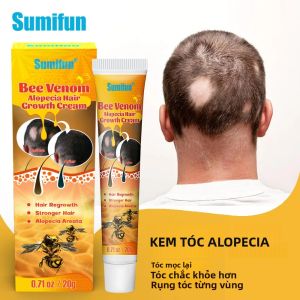 Kem Mọc Tóc Nhanh 7 Ngày Viên Nang Tinh Chất Chống Rụng Tóc Phục Hồi Da Đầu Hư Tổn Điều Trị Dành Cho Nam & Nữ Chiết Xuất Thảo Dược