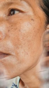 Ka Naya Paket Dark Spot BOOSTER Anti Flek Hitam