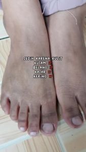 Paket 3pcs Glumevit Face Body Exfoliator Gel Penghilang Daki Perontok Kotoran Kulit