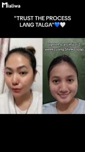 10 Pcs Shinko Age Freeze Beauty Soap: Hydrating Skin Care with Glutathione