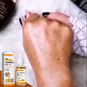 West&Month น้ำมันหอมระเหยขมิ้นชัน บำรุงผิวให้กระชับ ดูแลผิวอย่างอ่อนโยน น้ำมันเอสเซนส์บำรุงผิวหน้าให้ความชุ่มชื้น