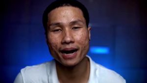 Everface serum เอเวอร์เฟส เซรั่มดูแลผิวหน้า ยืนหนึ่งในเรื่องสิว รอยสิว สวยอย่างปลอดภัย ไม่มีสารอันตราย 1 ขวด/15ml