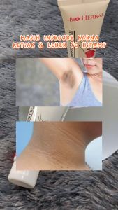 BIO HERBAL Brightening Underam Cream KETIAK Lipatan Hitam / Pemutih Ketiak dan Selangkangan Hitam Aman BPOM
