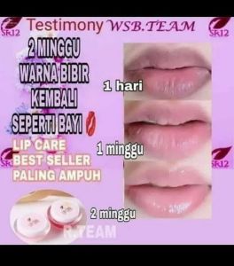 PEMERAH BIBIR ALAMI AMPUH!! PELEMBAB BIBIR LIP CARE SR12 BISA UNTUK BIBIR PEROKOK AMAN BUMIL DAN BUSUI LIP CARE TERLARIS!!! BIBIR HITAM BIBIR KERING PECAH PECAH NATURAL PINK CHERRY