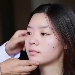 Serum Pemutih Efektif Penghilang Bintik Hitam Di Wajah serum Flek Hitam Melasma Membandel Tahunan Cream
