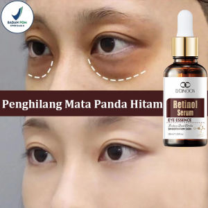 Penghilang Mata Panda Hitam: Serum Mata Panda Ampuh Menghilangkan Mata Panda Cepat 30ML