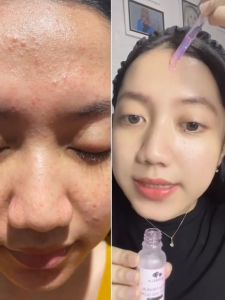 Quinella Niacinarame Serum Premium Bright & Glow