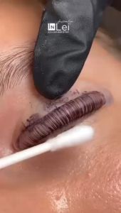 Perawatan Mata Yang Nyaman Dengan InLei® Filler 3 4ml
