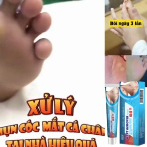 [ CHÍNH HÃNG] Loai bỏ nốt ruồi không ưng ý TAGS & MOLES REMOVER  Loại bỏ mụn ruồi trâumụn thịtmụn cóc mụn cơm cứng đầu nhanh chóng lấy lại làn da tự tin căng đẹp- Bút Xóa Mụn Cóc - Lazada