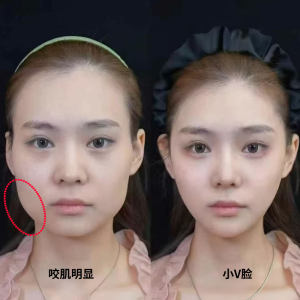 V Face Mask Men Women Universal Small Face Tool Big Face Enemy Beauty Device Skin Care Facial Treatment Full Body Application