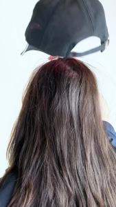 Red Blue Light Hair Growth Cap 470nm 630nm Anti‑Hair Loss Treatment Hat for Thinning Scalp Hairline & Crown Hair Regrowth