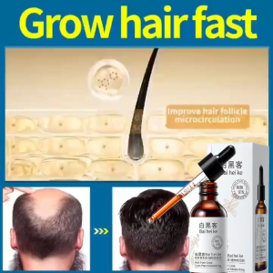 Hair Growth Essence 60ml Prevents Hair Loss Promotes Rapid Hair Growth Nourishes Hair Roots Moisturizes Natural Ingredients For Natural Hair Growth