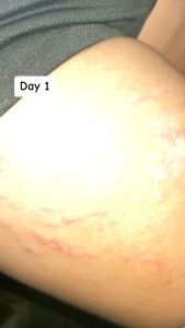 THE BEAUTYLAB AICHUN BEAUTY Original Anti-Stretch Mark Creamfor Pregnat Treatment for Improvement Scar Lighten Cream