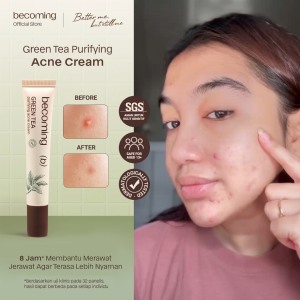 [SENSITIVE SKIN FRIENDLY] becoming Green Tea Purifying Acne Cream 15gr | Acne Spot Treatment | Obat Jerawat | Totol Wajah Berjerawat | Acne Sul | Berjerawat Meradang & Memudarkan Bekas Jerawat Sulfur + Salicylic Acid + Ceramide