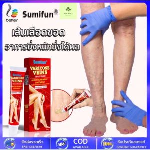 ครีมสำหรับทาขา เส้นเลือดขอด 20 กรัม