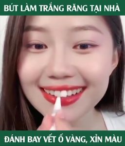 Bút Tẩy Trắng Răng Dazzling White Instant Whitening Pen Của Mỹ