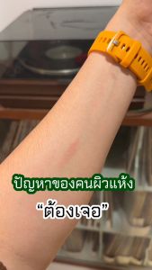 ครีมแก้คัน คันเรื้อรัง คันในร่มผ้า ผิวแห้งลอก สูตรสำหรับผู้ชาย ไทยแท้ แฟมิลี่ บัตเตอร์ 14g. ปลอดภัย ไม่มีสเตียรอยด์